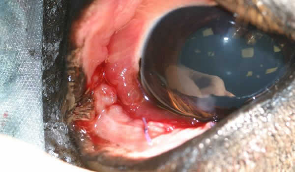 carcinoma eye
