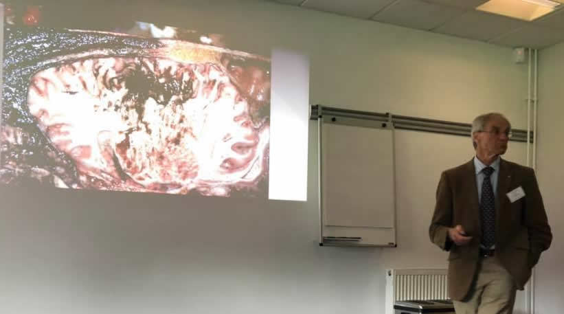 Derek Knottenbelt lecturing on equine sarcoid treatment