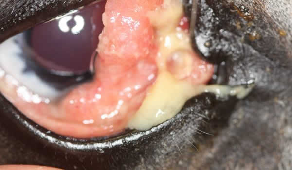 squamous cell carcinoma eye