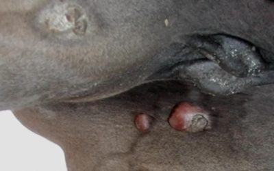 Article on treating tumours